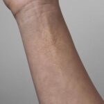 A delicate white ink water lily outline tattoo on a person's forearm.