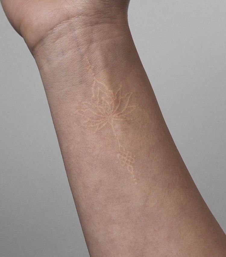 A delicate white ink water lily outline tattoo on a person's forearm.